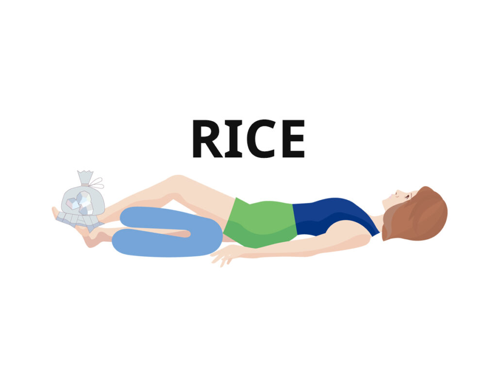 怪我の応急処置RICE